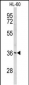 PEX14 Antibody (C-term)