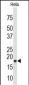 COX4I1 Antibody (N-term)