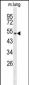 MUTYH Antibody (Center)