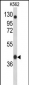 APOBEC3F Antibody (N-term)