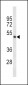 TPH2 Antibody (Center)