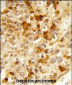 PXMP3 Antibody (Center)
