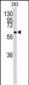 CDC73 Antibody (Center)