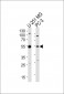 DEK Antibody (C-term)