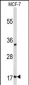DSTN Antibody (Center)