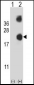 DSTN Antibody (Center)