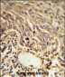 EIF4A2 Antibody (C-term)