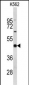 EIF4A2 Antibody (C-term)