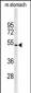 KCNJ11 Antibody (N-term)