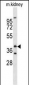 FOXL1 Antibody (Center)