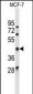 ATXN3 Antibody (Center)