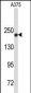 TOP2A Antibody (C-term)