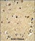 PLCB2 Antibody (N-term)