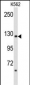 PLCB2 Antibody (N-term)