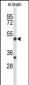 MEF2A Antibody (Center)