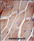 RPL5 Antibody (N-term)