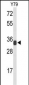 RPL5 Antibody (N-term)