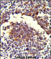 C7 Antibody (Center)