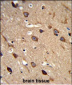 ACCN2 Antibody (C-term)