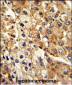 ATP1B2 Antibody (Center)
