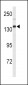 XDH Antibody (N-term)