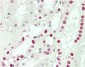 SNRPD3 Antibody (C-term)