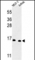 SNRPD3 Antibody (C-term)