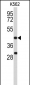 DFFA Antibody (C-term)