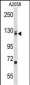 EFTUD2 Antibody (Center)