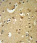 GABRA2 Antibody (C-term)