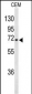 GABRA4 Antibody (Center)