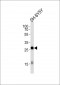 GPM6A Antibody (C-term)