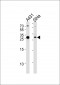 HSD17B12 Antibody (Center)