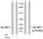 4E-BP1 Antibody (T45)