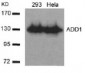 ADD1 Antibody (S726)
