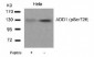 Phospho-ADD1-S726 Antibody