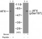 Phospho-AFX-S197 Antibody