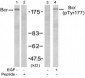 Bcr Antibody (Y177)