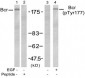 Phospho-Bcr-Y177 Antibody