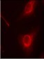 Phospho-Cofilin-S3 Antibody