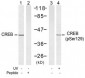 CREB Antibody  (S129)