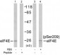 EIF4E  Antibody (S209)