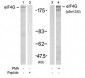 EIF4E  Antibody (S1232)