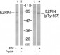 Phospho-Ezrin-T567 Antibody