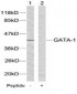 GATA1  Antibody (S142)