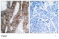 Integrin Beta-3 Antibody (Y773)