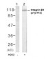 Phospho-Integrin Beta-3-Y773 Antibody