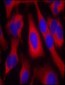 IRS-1  Antibody (S636)