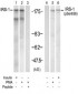 IRS-1  Antibody (S636)