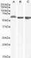 Goat Anti-58KGolgi protein(Internal)/FTCD Antibody